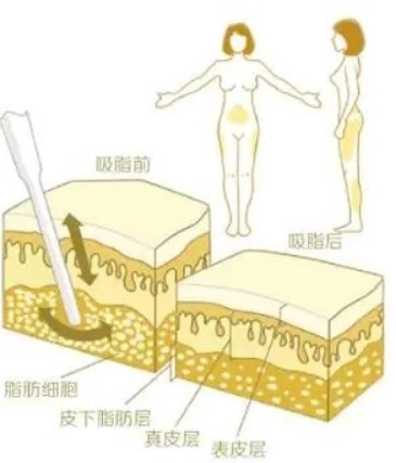 QQ浏览器截图20210910105525.png